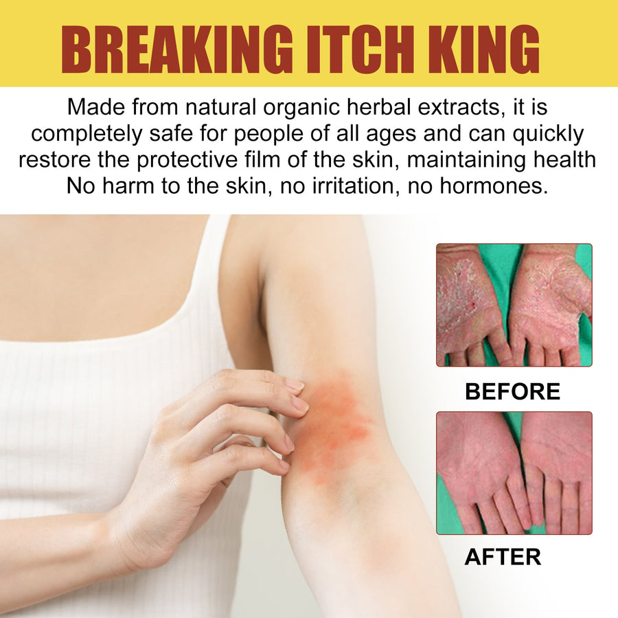 Breaking Itch King – Fast Herbal Relief for Itching, Fungal
