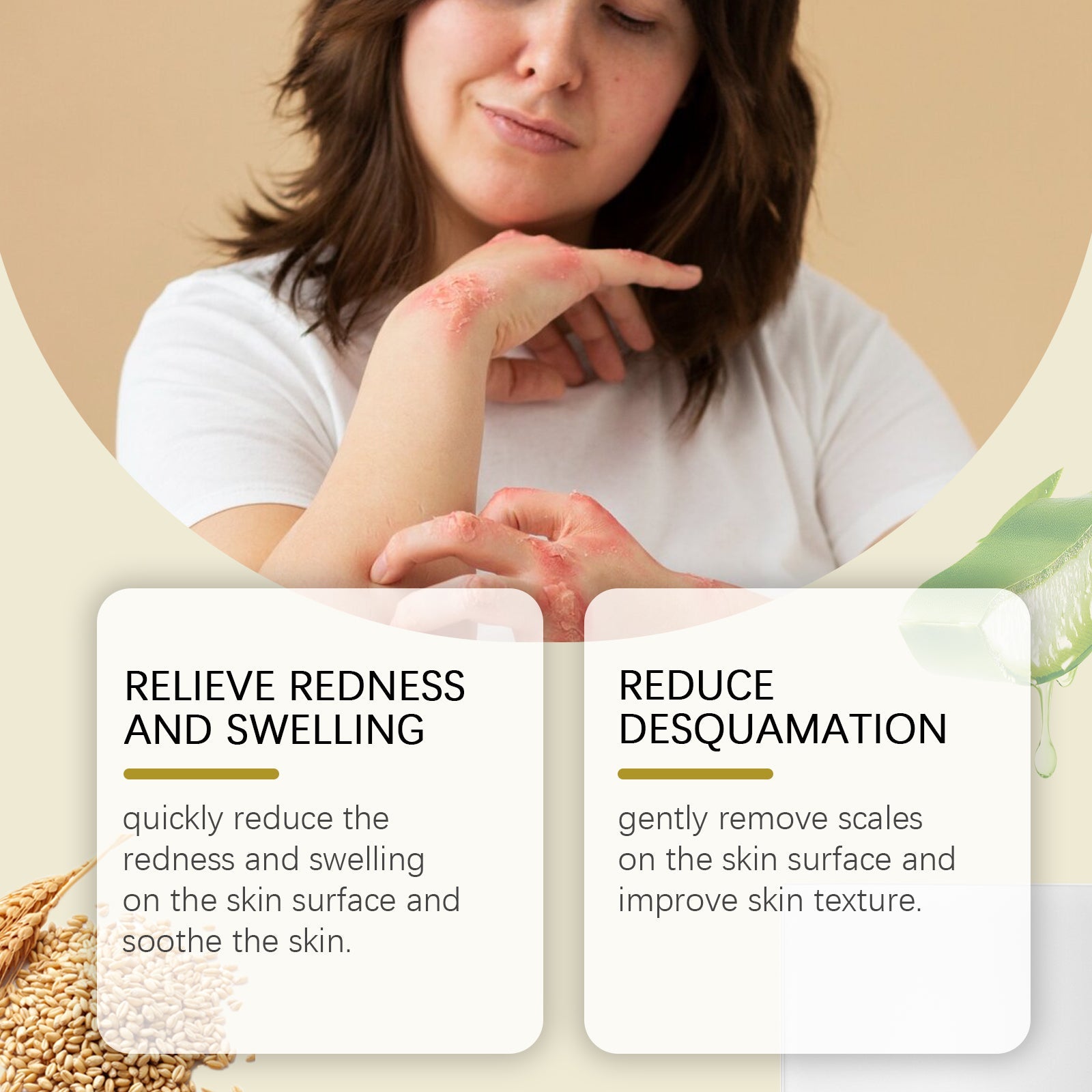 Woman displaying irritated, reddened, and scaled skin on hands and arm, with text claims 'Relieve Redness and Swelling' and 'Reduce Desquamation'