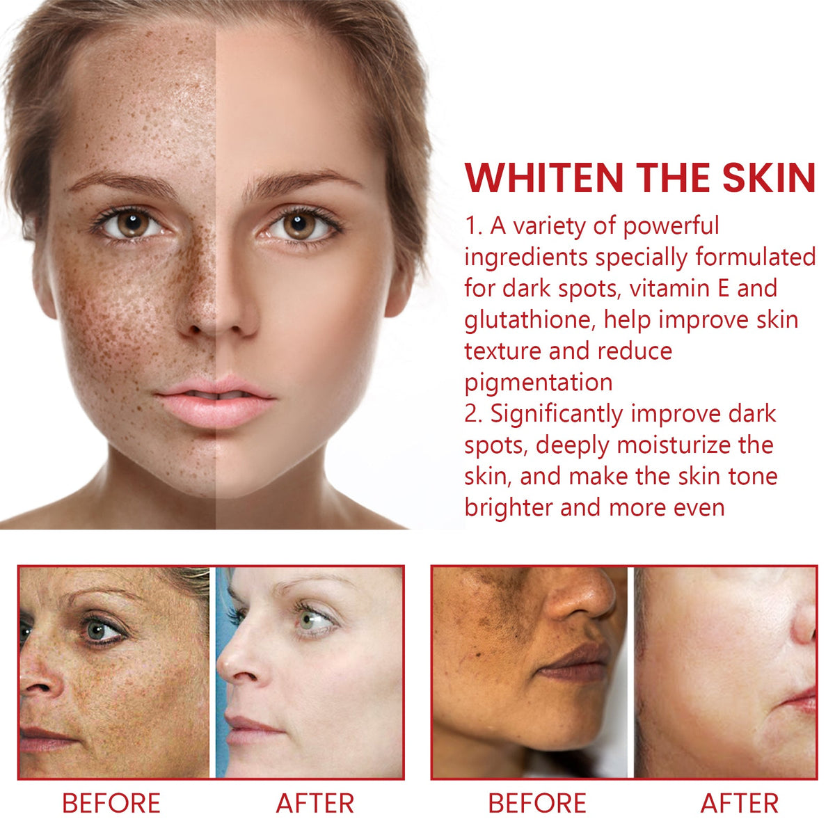 Dark Spot Repair Cream for Visibly Brighter Skin in 1 Week