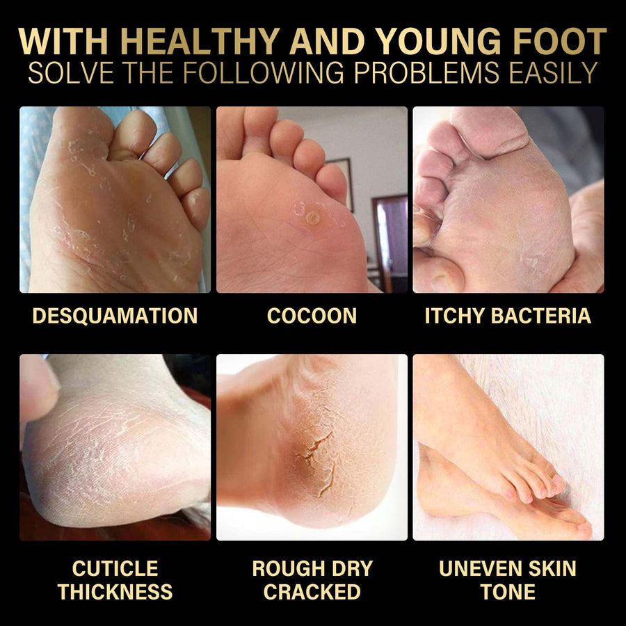 Lavender Foot Peel Mask for Soft, Crack-Free Heels