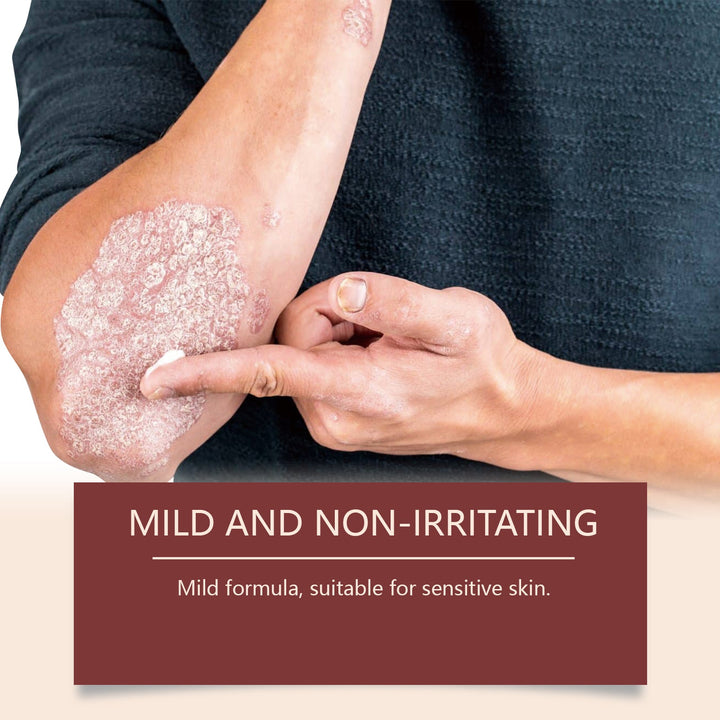 WoodSleep Tallow Cream for Dry, Sensitive Skin Relief