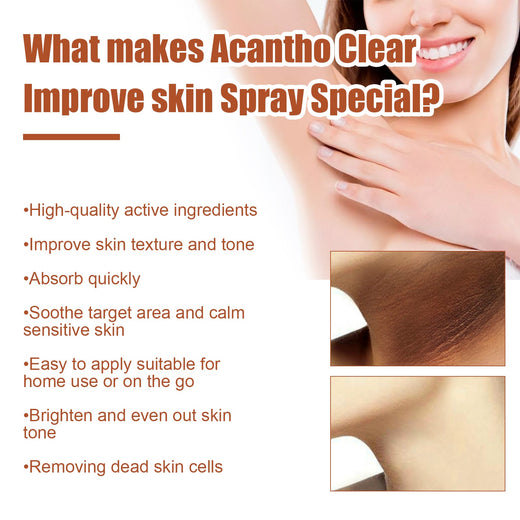 Acantho Clear Spray for Dark Elbows & Knees