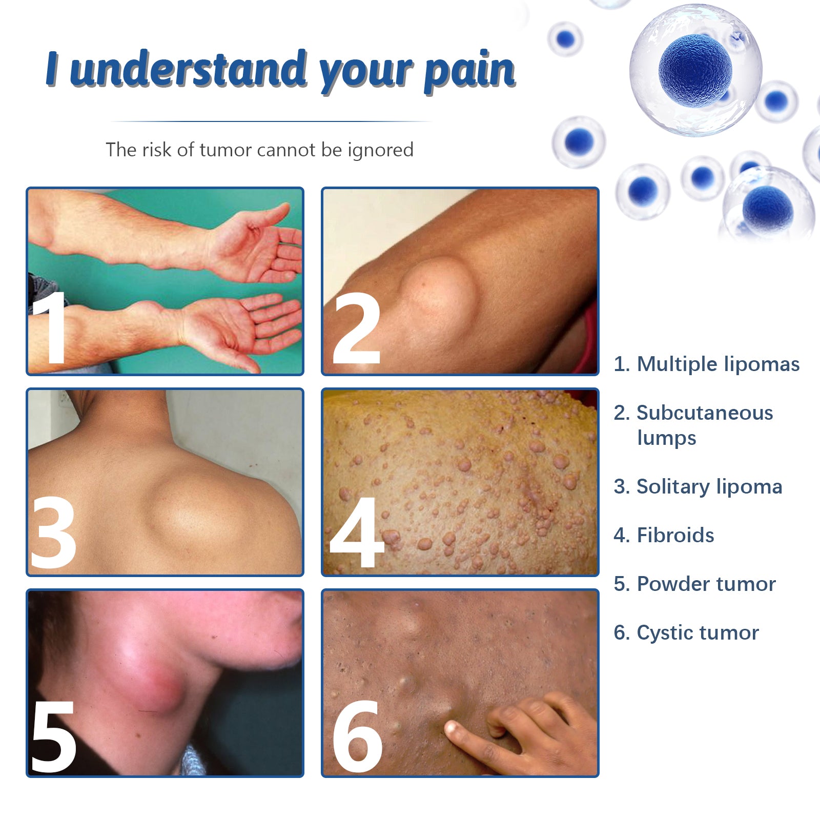 Illustrated lifestyle scene showing spray being applied to shoulder/upper back area with magnified cross-section of lipoma tissue and application demonstration