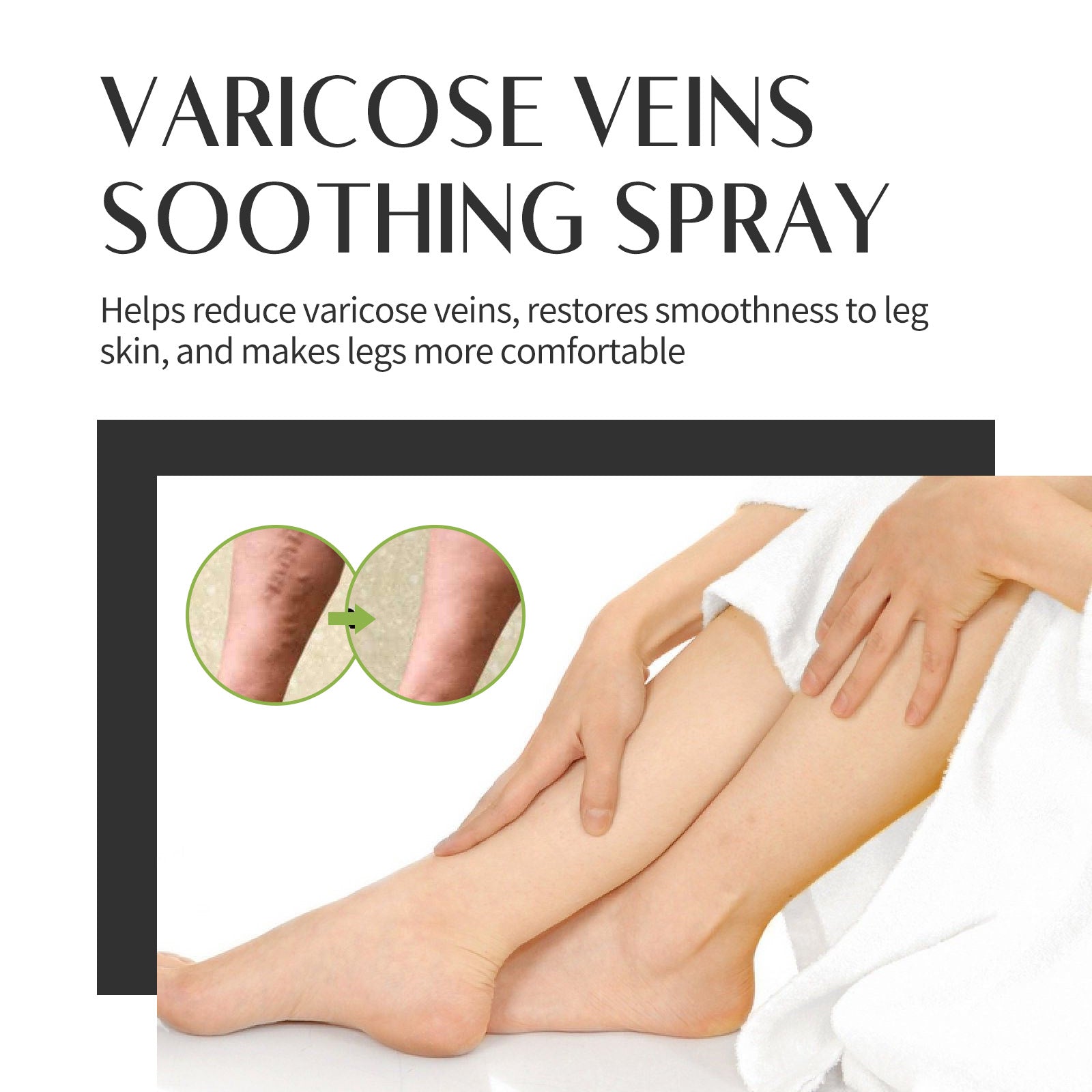 Clinical before/after comparison with inset circles showing varicose vein reduction on calf, plus hands massaging treated leg