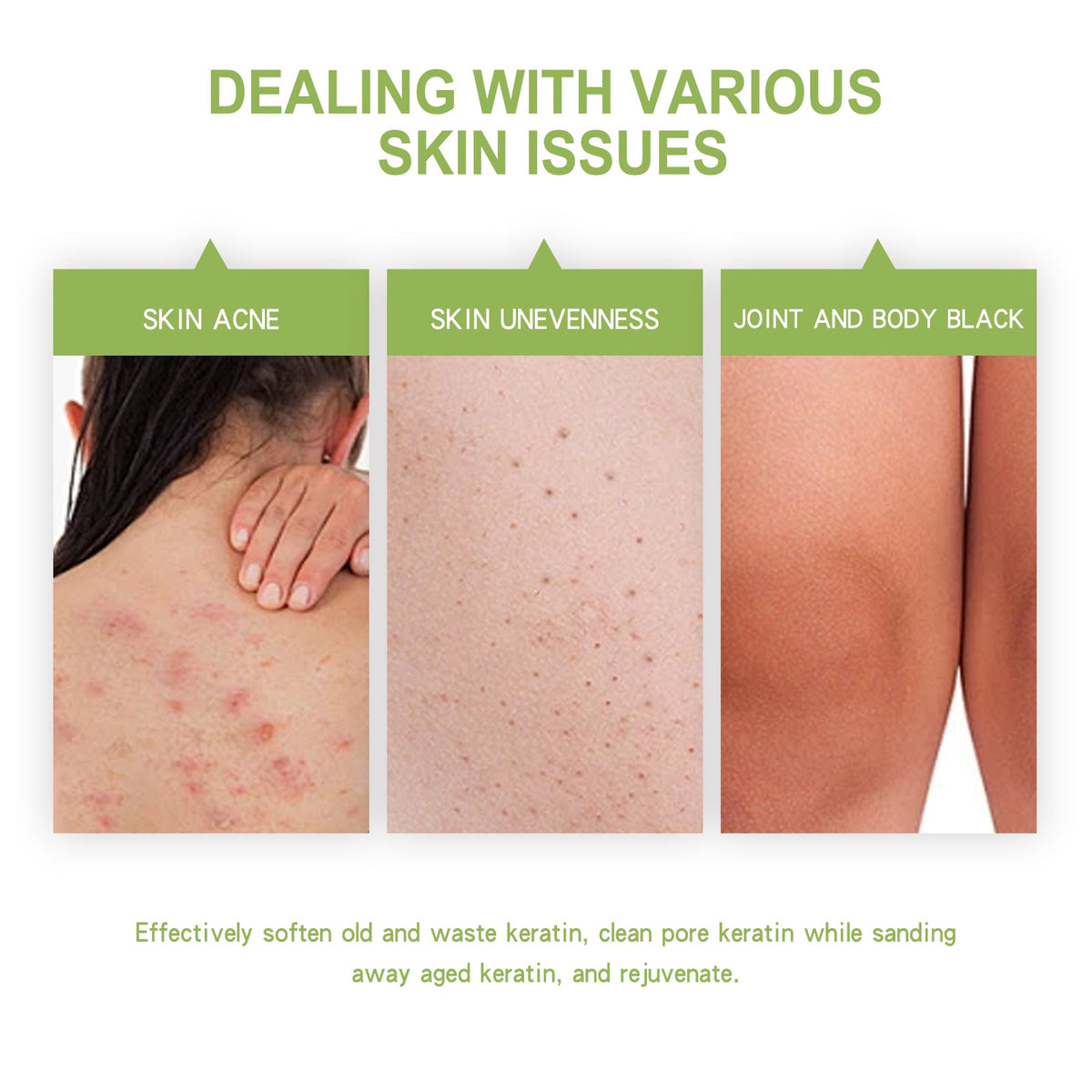 Avocado Body Scrub for Rough, Bumpy Skin & Dark Spots