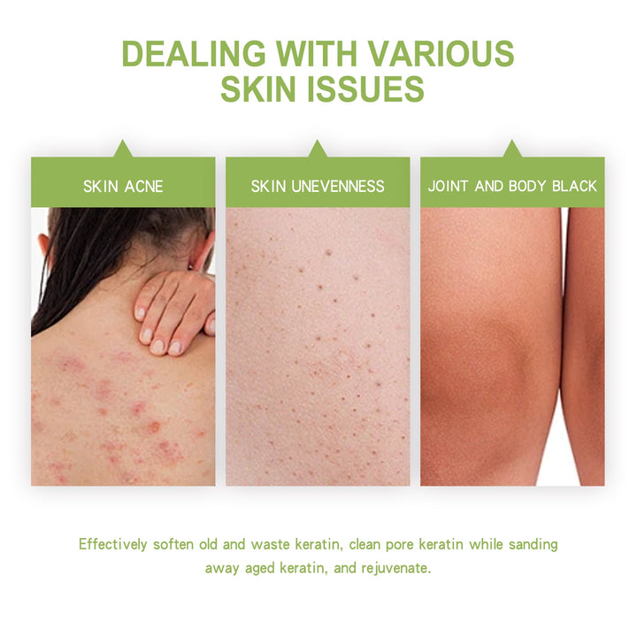 Avocado Body Scrub for Rough, Bumpy Skin & Dark Spots