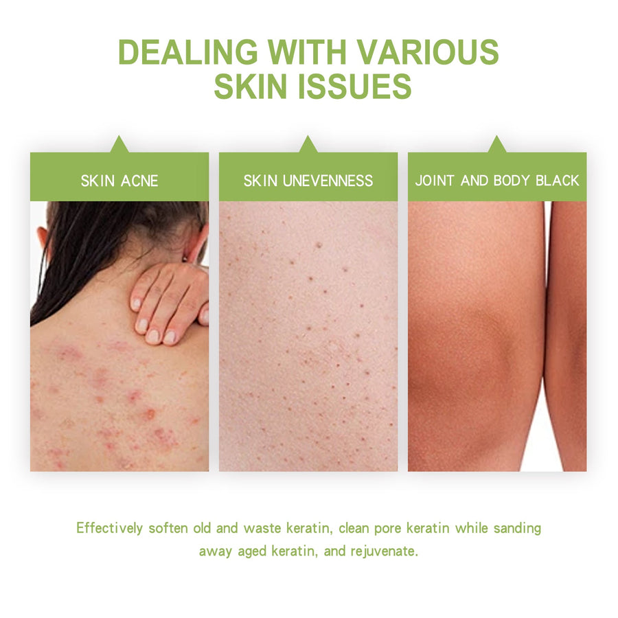 Avocado Body Scrub for Rough, Bumpy Skin & Dark Spots