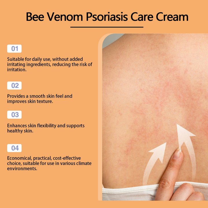 Bee Venom Cream for Itchy Red Psoriasis-Prone Skin
