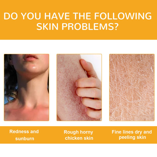 Vitamin C Brightening Cream for Age Spots & Dull Skin