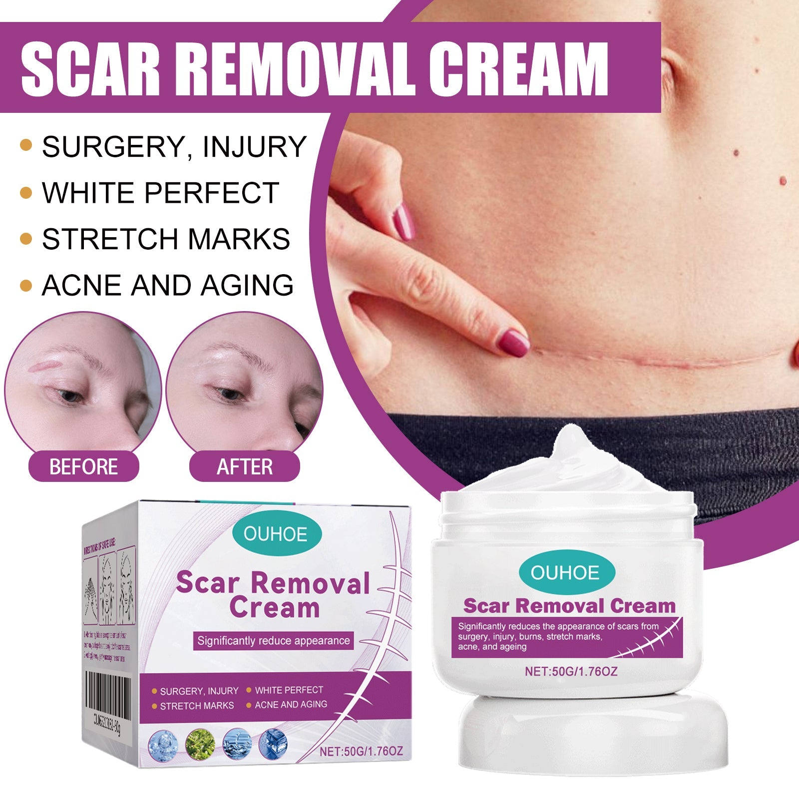 Lifestyle image showing scar removal results with close-up before/after comparison of forehead scar and portrait of woman applying cream to her face
