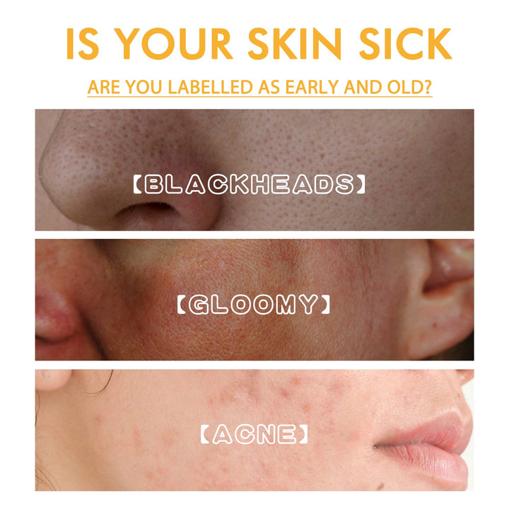 Honey Peel Off Mask for Blackheads and Dark Spots