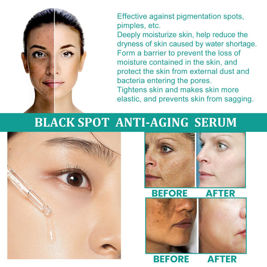 Peptide Serum for Dark Spots & Fine Lines