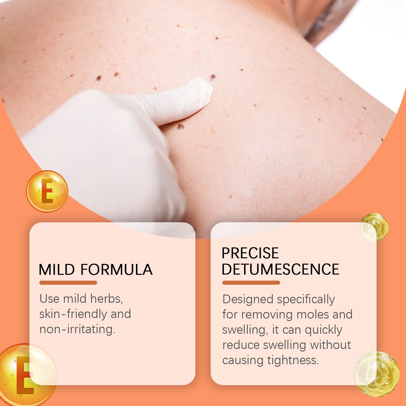 Application demonstration on body skin with visible moles and bumps; white gel applied with visible results; information cards highlighting 'Mild Formula' and 'Precise Detumescence'