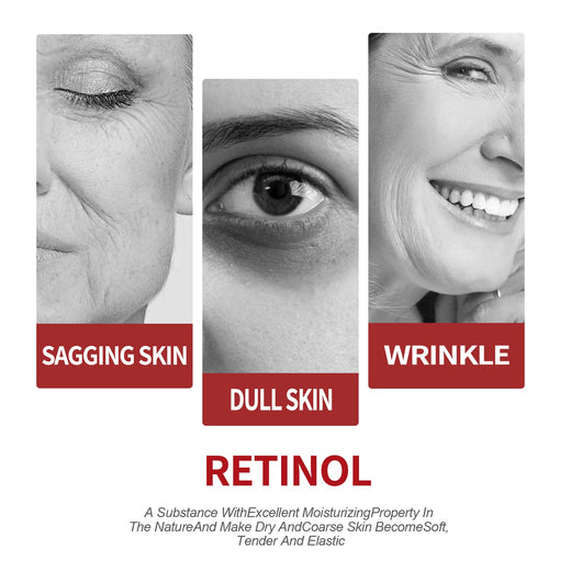 Retinol Moisturizing Cream — Firmer, Brighter Skin