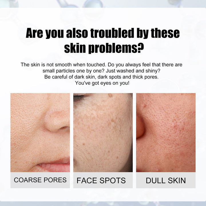 Nicotinamide Pore Essence for Visibly Smaller Pores