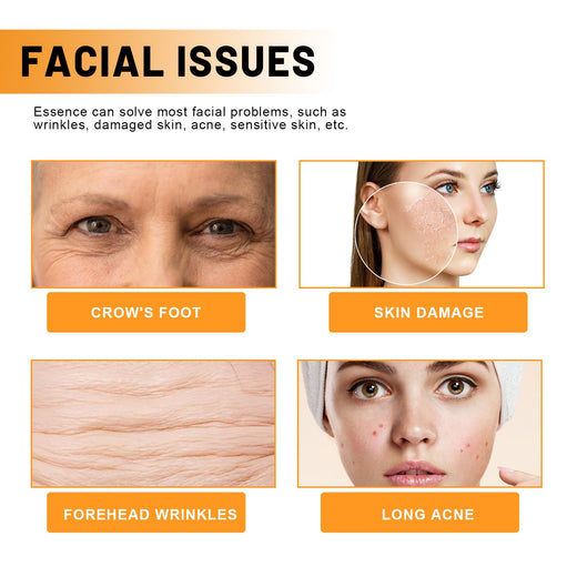 Vitamin C Face Essence for Fine Lines & Uneven Tone