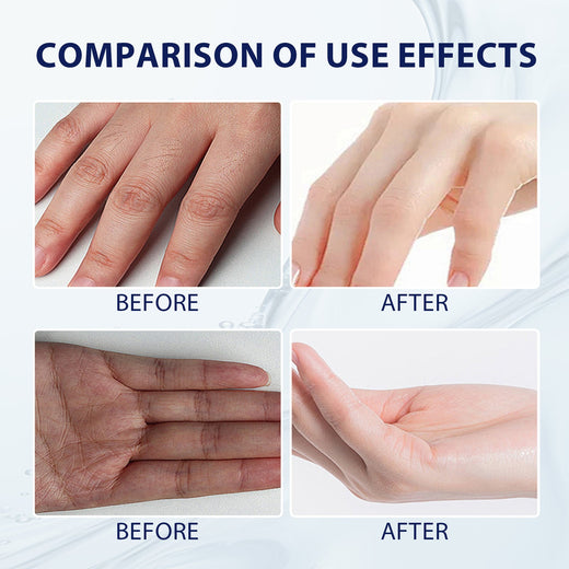 Aloe Vera Hand Cream for Dry, Cracked Skin Repair