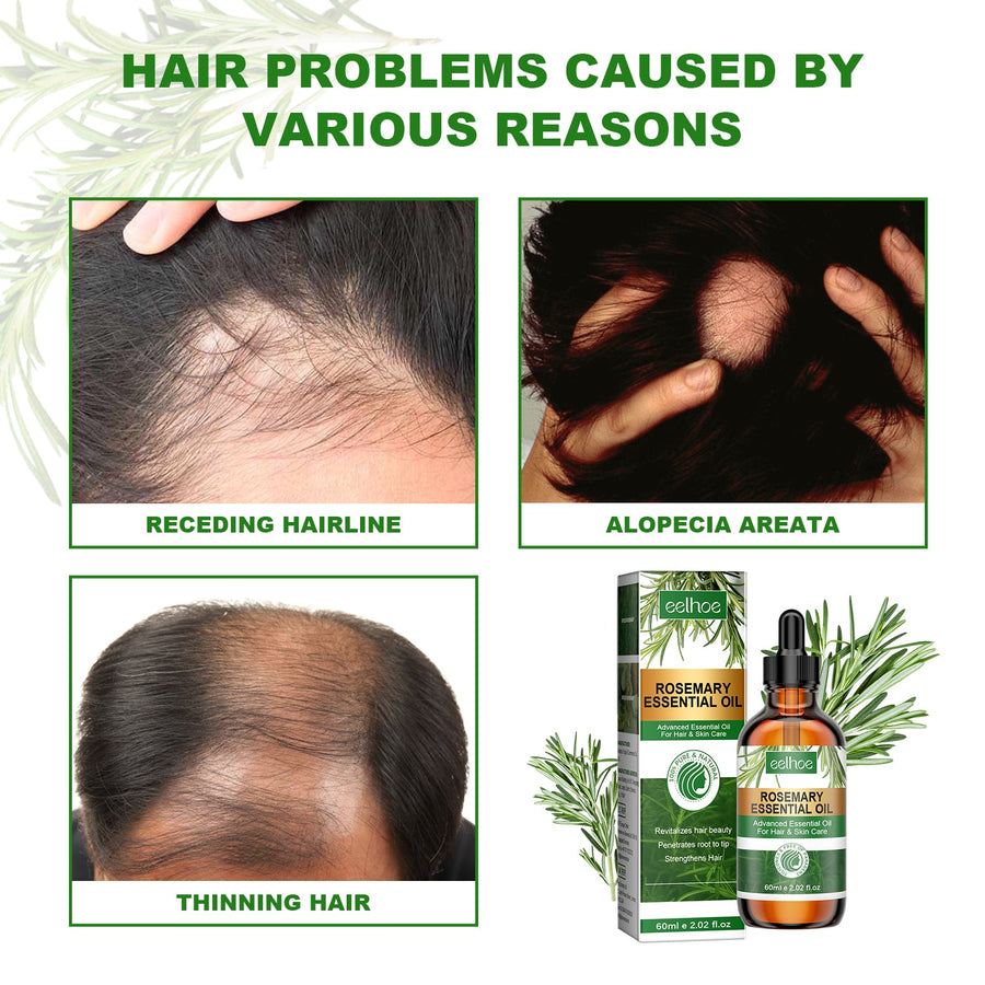 Rosemary Hair Oil For Softer, Stronger-Looking Hair