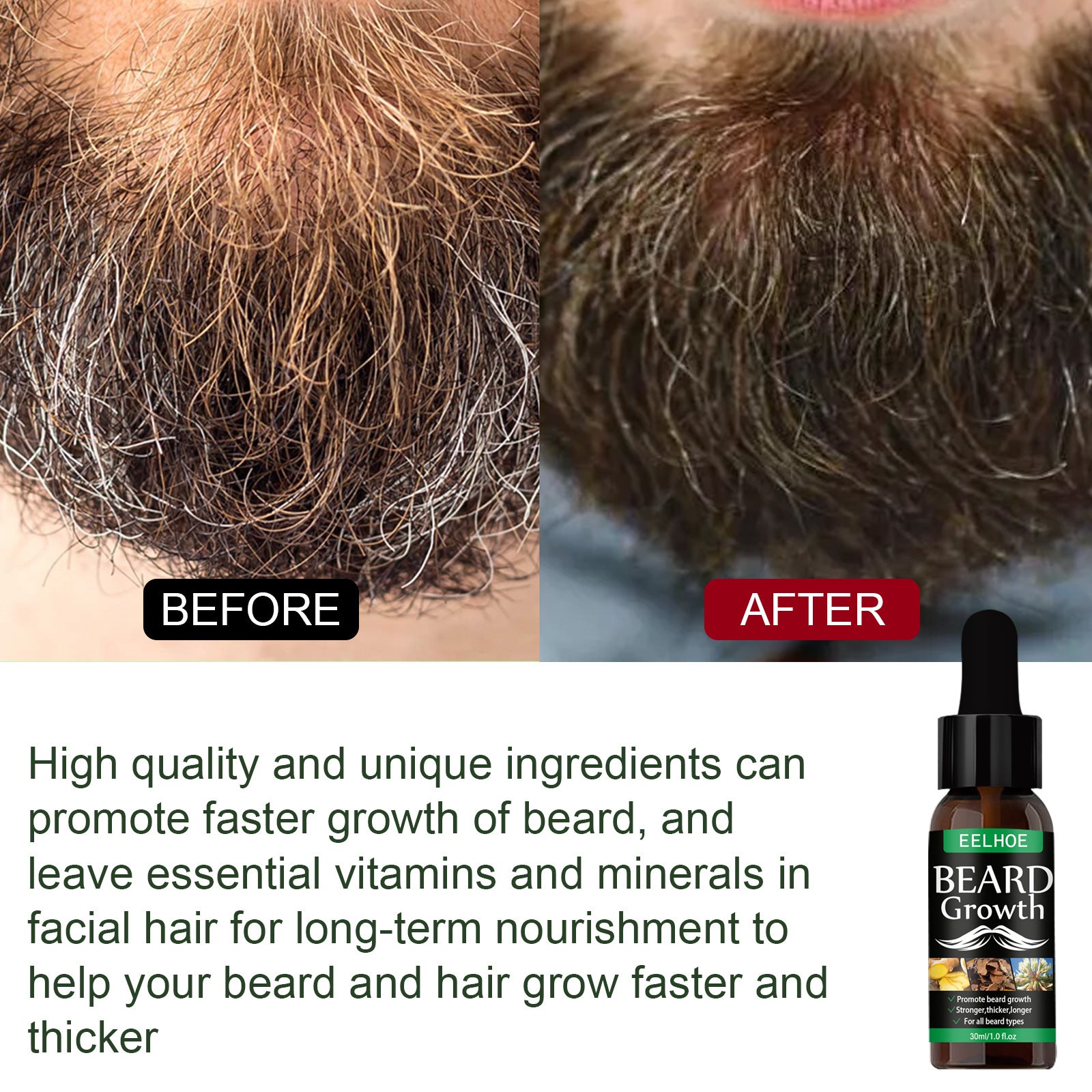 Close-up before and after comparison of beard hair texture showing sparse, wiry light beard before treatment and dense, dark, well-defined beard after treatment