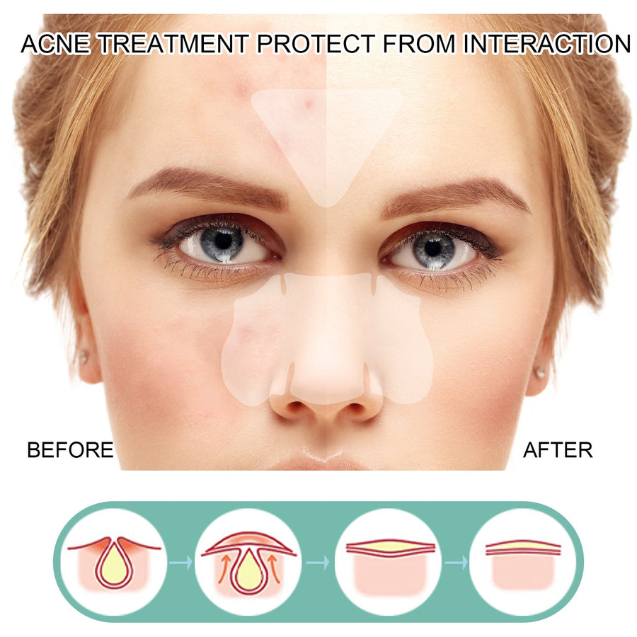 Face Pimple Patches — 132 Invisible Healing Spots for All
