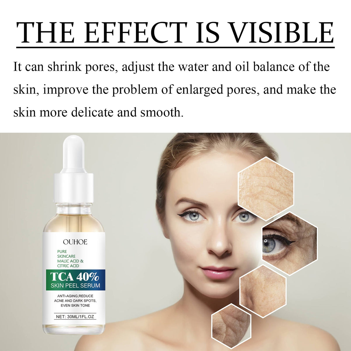 TCA 40% Peel Serum for Pores, Lines & Dark Spots