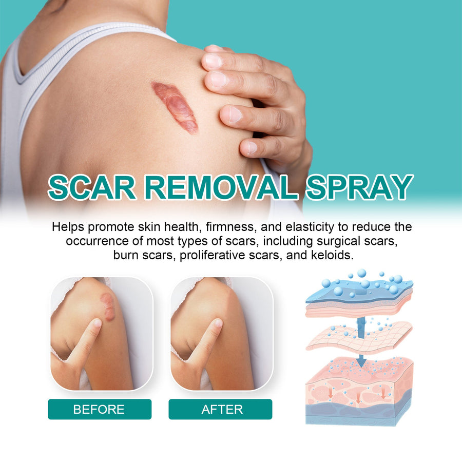 Medical Grade Scar Spray — Smooths & Fades All Scars | South Moon