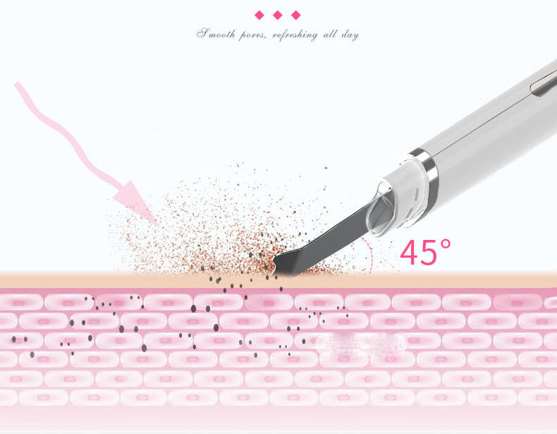 Ultrasonic Skin Spatula — Deep Pore & Blackhead Removal