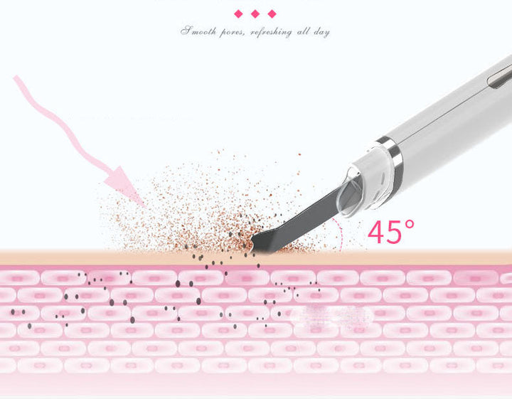 Ultrasonic Skin Spatula — Deep Pore & Blackhead Removal
