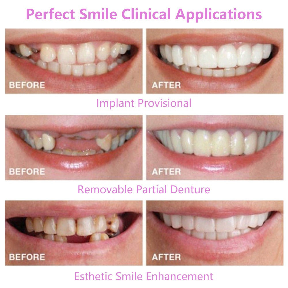 Multiple dental arch configurations displayed with lifestyle smile result