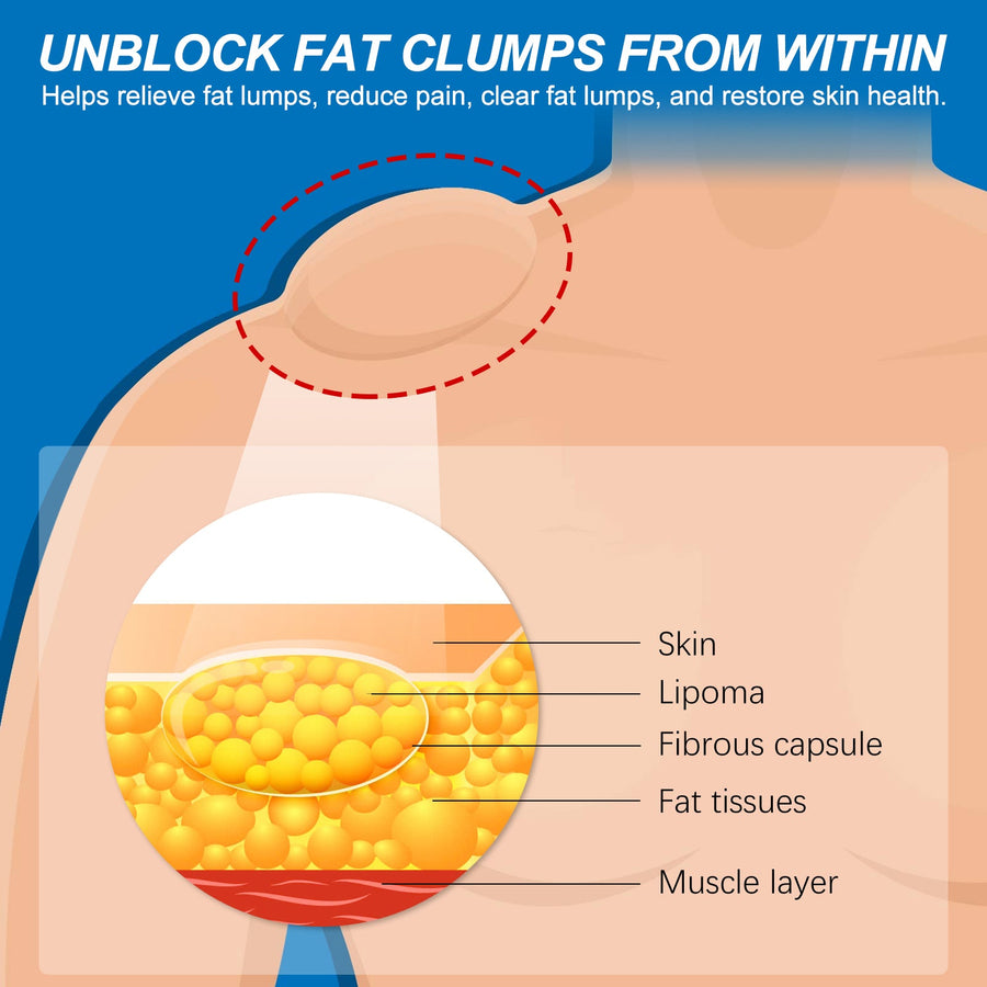 South Moon Lipoma Spray — Plant-Based Fat Lump Reduction