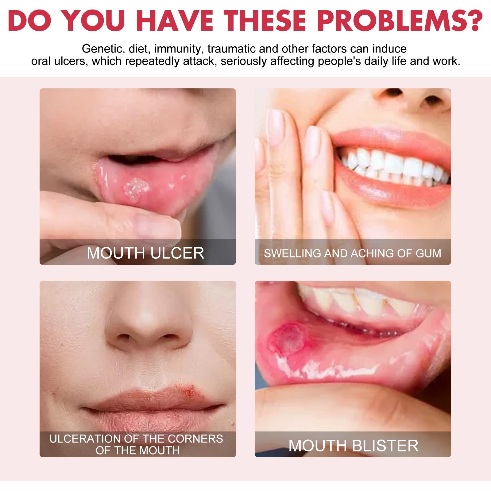 Before/after results showing four different oral ulcer healing scenarios with woman demonstrating pain relief