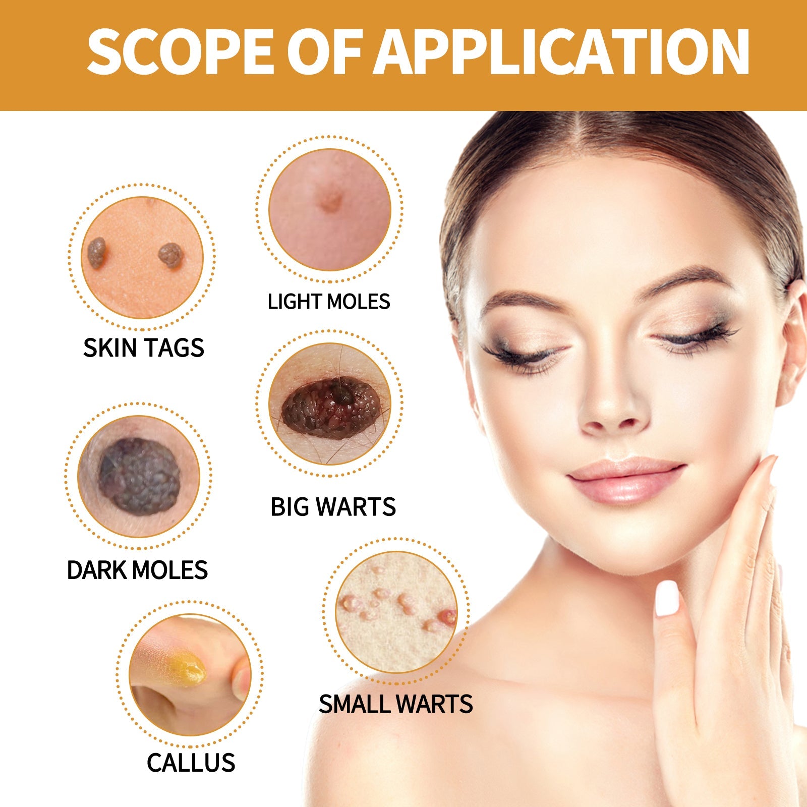 Comprehensive diagram showing scope of application with close-ups of skin tags, light moles, dark moles, big warts, small warts, and callus lesions, plus portrait of clear-skinned woman