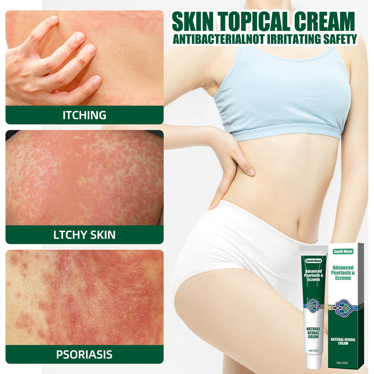 Herbal Soothing Cream for Dry, Itchy & Irritated Skin