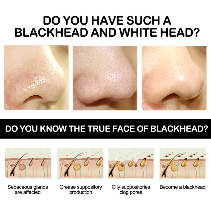 Bamboo Charcoal Peel-Off Mask for Blackhead Removal