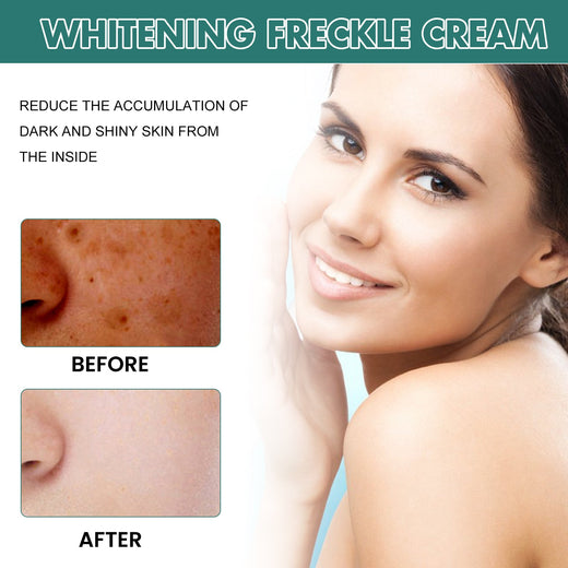 Brightening And Spot Reducing Cream Lightening And Moisturiz