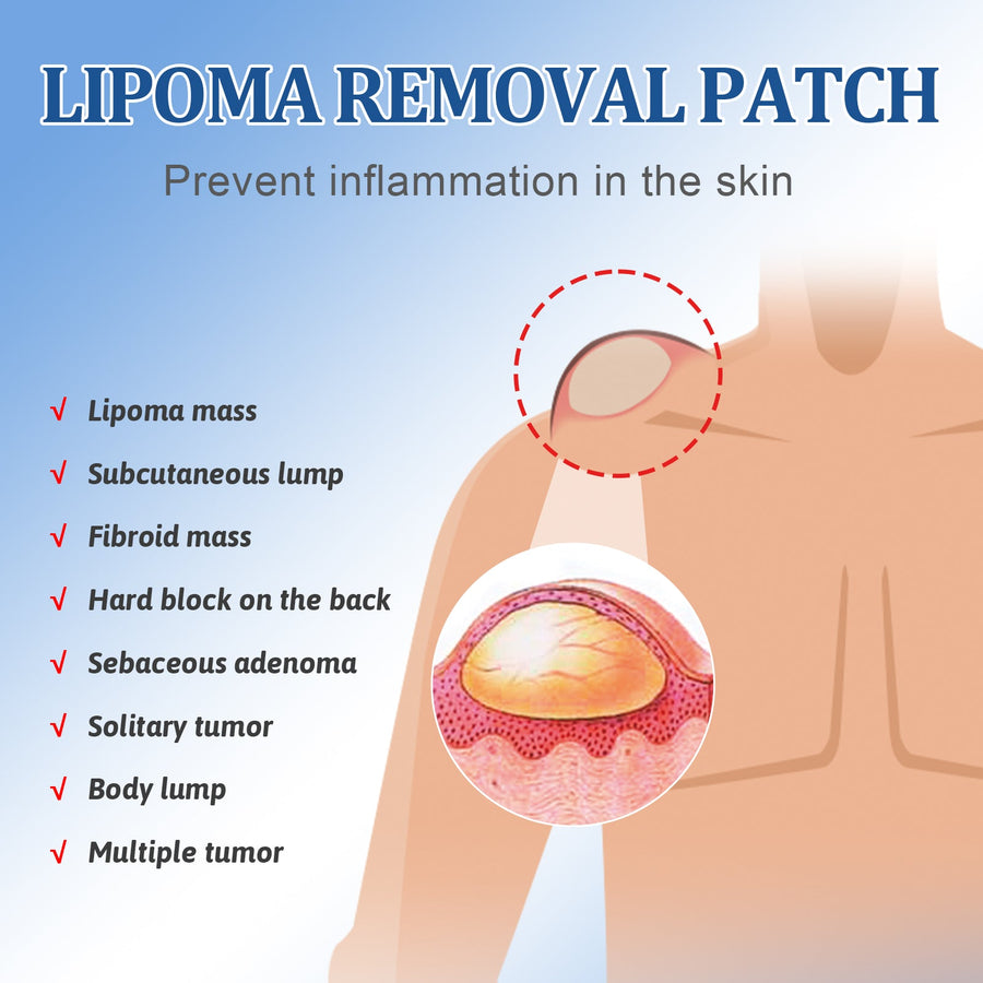 Lipoma Removal Patch — Dissolve Subcutaneous Lumps Naturally