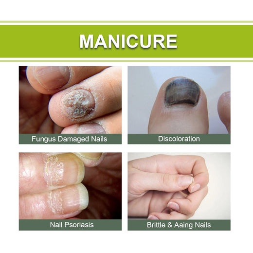Nail Repair Gel for Damaged, Discolored, Brittle Nails