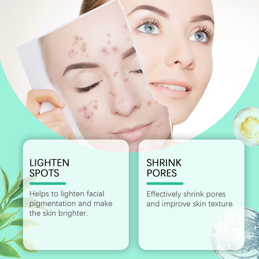 Glycolic Acid Peel Pads for Pores, Texture & Dark Spots