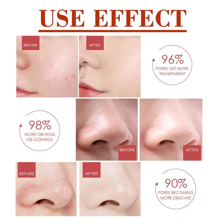 Pore Minimizer Serum - Refined-Looking Skin