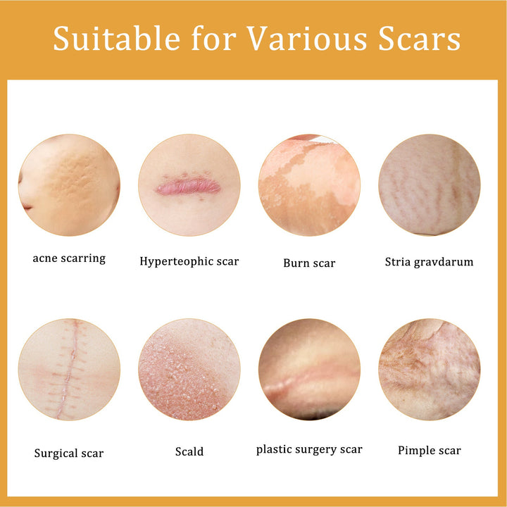 Scar Repair Cream — Fades Scars & Restores Smooth Skin