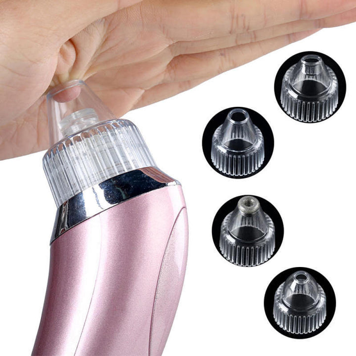Pore Vacuum Blackhead Remover — Clearer Skin in 2 Weeks