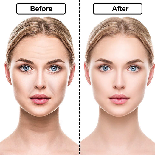 Silicone Wrinkle Patches for Reusable Smoothing Care