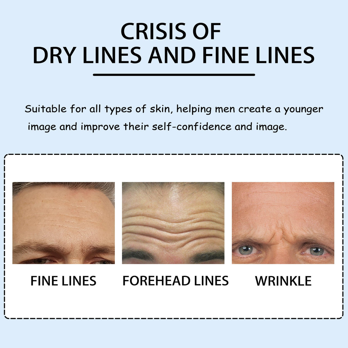 Men's Forehead Wrinkle Patches for Smoother-Looking Skin