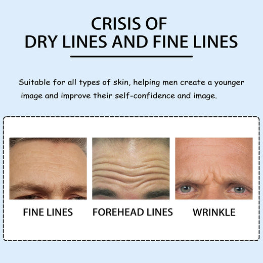 Men's Forehead Wrinkle Patches for Smoother-Looking Skin