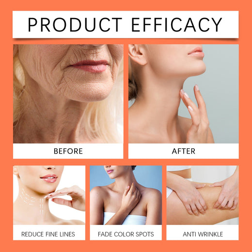 Smoothing Body Serum for Uneven Tone & Blemishes