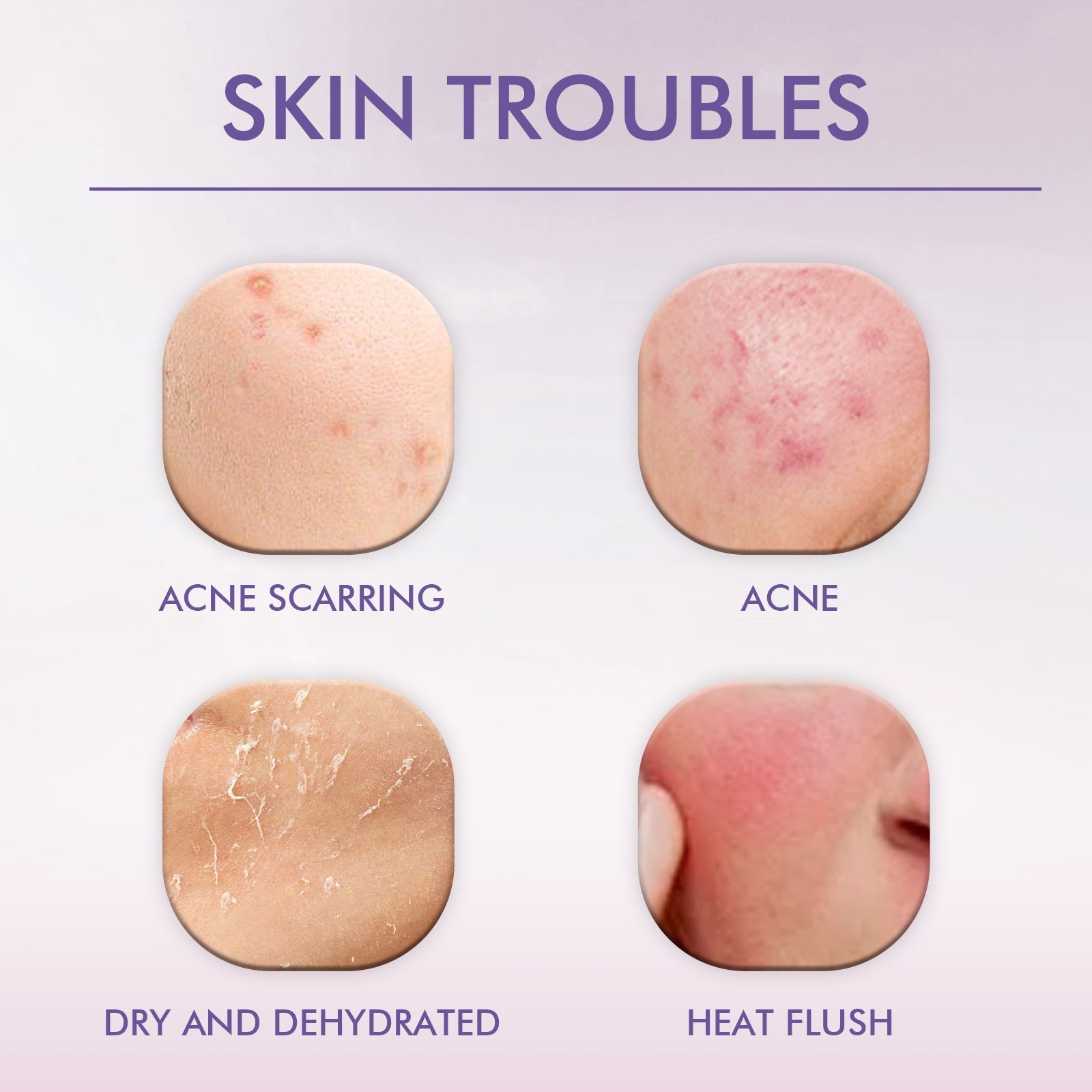 BELHOE Pimple Patches box with packaging display and open pouch showing individual translucent patches