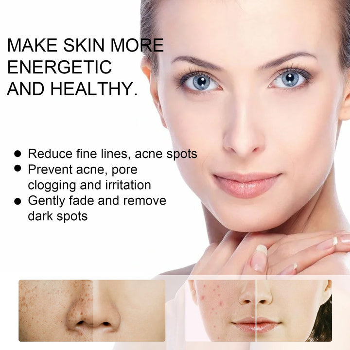 Dual-Formula Acne Cream Set — Clear Skin & Fade Dark Spots