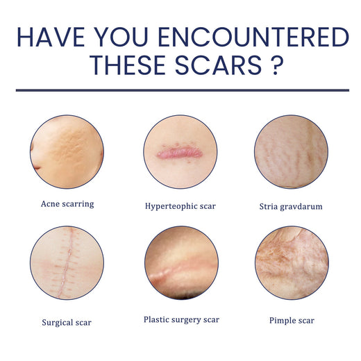 Advanced Silicone Scar Gel - Fades New & Old Scars Visibly