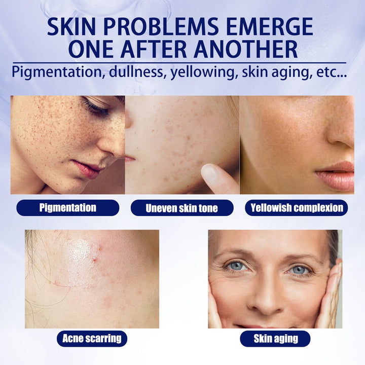 Vitamin C Facial Essence for Spots, Acne & Fine Lines