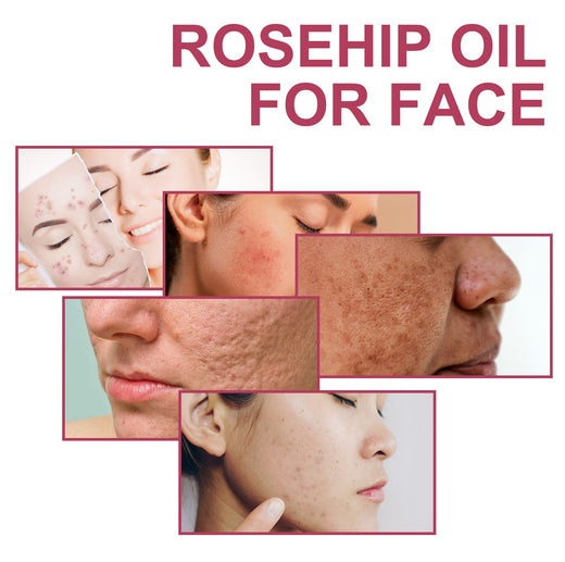 Rosehip Oil For Face, Delicate Pores Smooth Repair Facial Mo